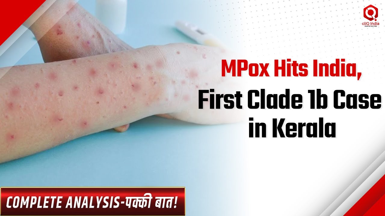 Mpox in India: First Clade 1b Case and the Global Health Crisis | WHO ...