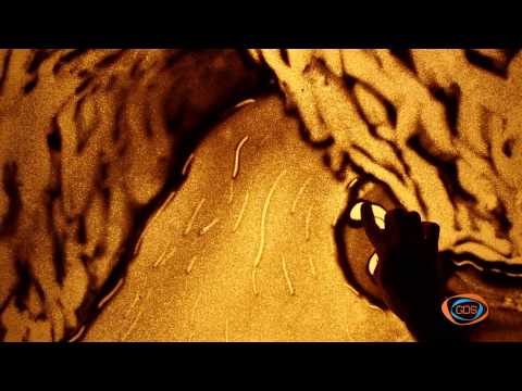 ვიდეო: რა არის აქილევსის ქუსლი