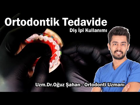 Video: Diş Ipi Baubles Nasıl örülür