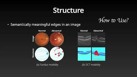 Encoding Structure-Texture Relation with P-Net for Anomaly Detection in Retinal Images