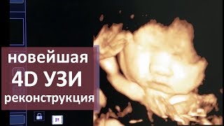 УЗИ исследование. 💡 Новейшие возможности УЗИ исследования. Моситалмед