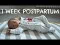 1 WEEK POSTPARTUM AND BABY UPDATE