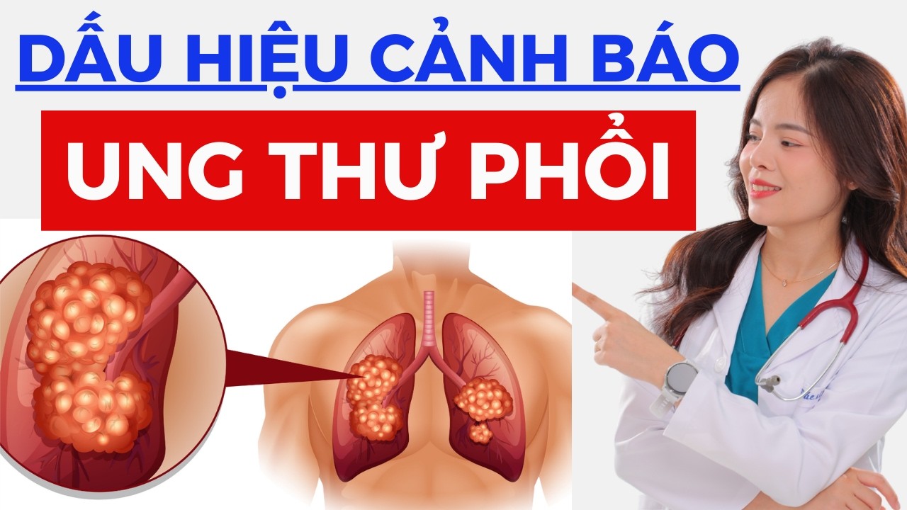 UNG THƯ PHỔI: Triệu chứng, Dấu hiệu nhận biết và Cách phòng tránh | Dr Thùy Dung