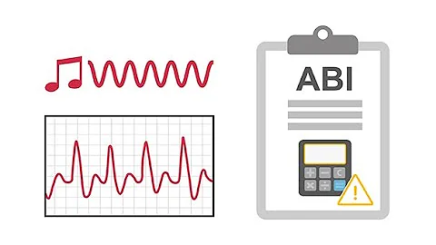 Interpreting ankle brachial index (ABI) waveforms