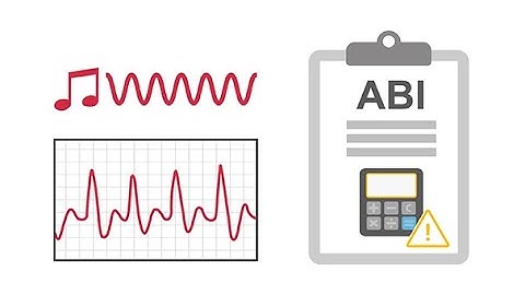 Interpreting ankle brachial index (ABI) waveforms
