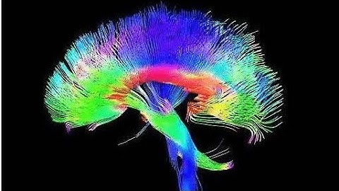 Diffusion MRI Explained: Mapping the Brain’s Hidden Highways 🧠 | Part 1 – Theory