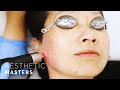 Is PicoSure Laser safe for Asian skin? - Skin Rejuvenation and Pigmentation