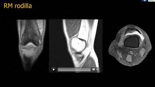 Anatomía RM Rodilla