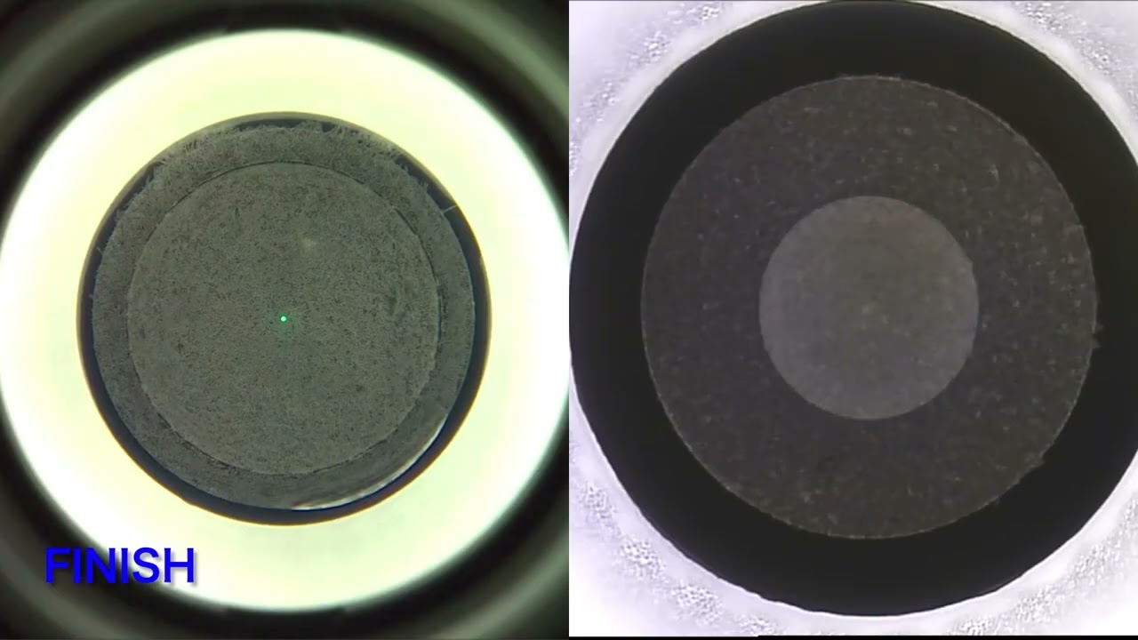 SMILE（スマイル）｜南青山アイクリニック東京｜屈折矯正手術専門施設