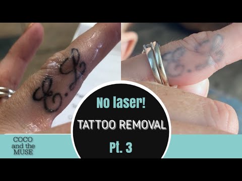 PART 3 ~ GETTING RID OF TATTOO WITHOUT LASER ~ Q & A