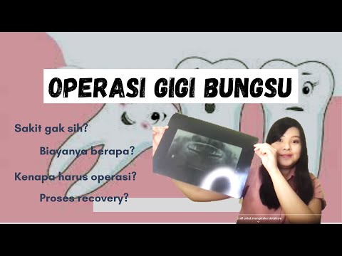 Sharing Pengalaman OPERASI GIGI BUNGSU (Wisdom Teeth) + Biaya + Jenis Makanan + Proses Recovery