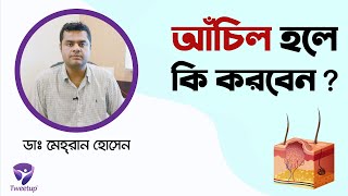 শরীরে আঁচিল কেন হয় এবং যা করণীয়। [4K]