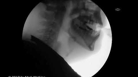 Chapter 2: 05 EMBOUCHURE: Formation