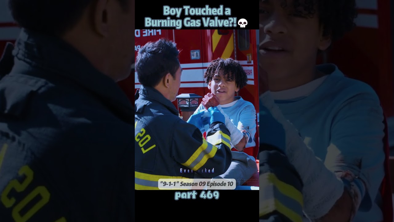 Boy Touched a Burning Gas Valve?!💀【Part 469】