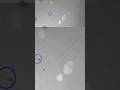 Magnetosperm: A Sperm-Inspired Medical Micro Robot 🧲 | #Shorts #nanotechnology #sperm #futuretech