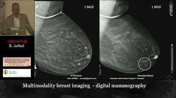 IBUS: Multimodality Breast Imaging Course.2019