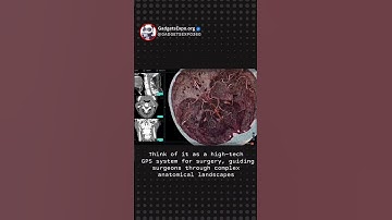 2D scans ➡️ 3D holograms on patients 🧠 #ai #aitools #machinelearning #tech #hologram