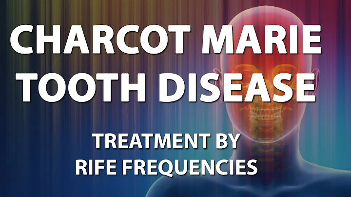Charcot Marie Tooth Disease - RIFE Frequencies Treatment - Quantum Medicine with Bioresonance