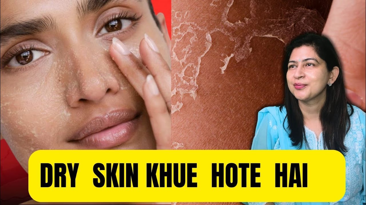 Winter Dry Skin Explained | Causes, Skincare Tips & Best Treatment | Dr Cheena Langer