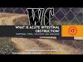 What is acute intestinal obstruction? Types, symptoms and treatment
