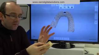 TRIOS   Implant Scanning