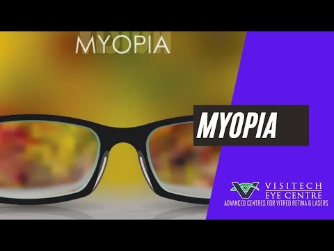 What is Myopia? | Symptoms of Myopia | Myopia Treatment in Delhi