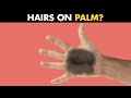 Why Hairs Grow On Palms Of Some People? (Urdu/Hindi)