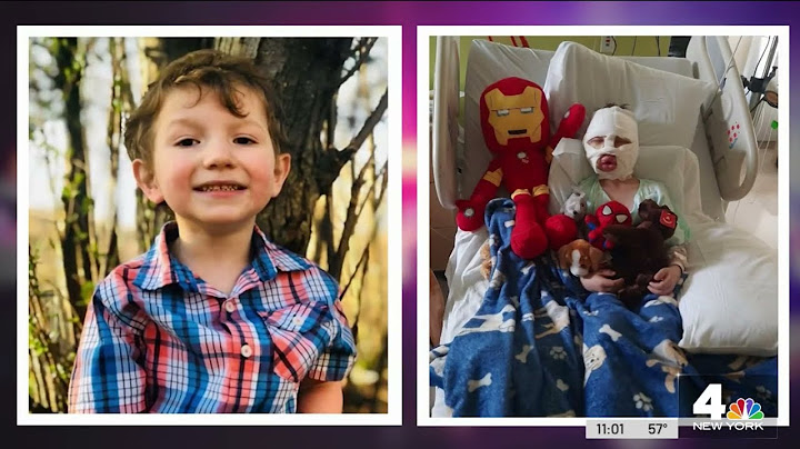 Backyard Bullies Light 6-YEAR-OLD BOY on Fire, Family Says They 'Watched Him Burn' | NBC New York