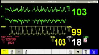 Healthcare simulation beyond CPR: VT or not VT screenshot 4