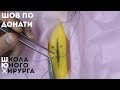 шов мак-миллана - донати или вертикальный п-образный шов (техника; как наложить)