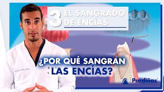 ¿ENCÍAS SANGRANTES? Causas y tratamiento del sangrado de encías  / #Shorts