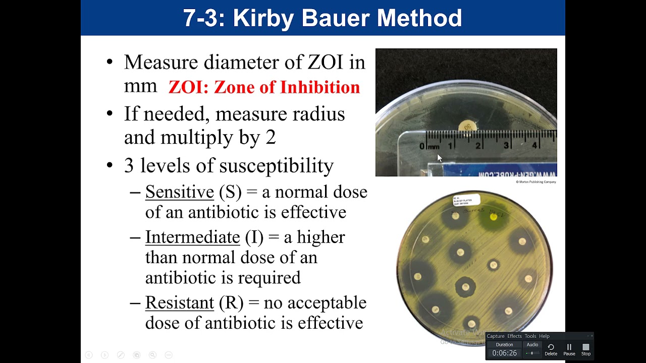 Lab 7-3: Kirby Bauer (Antibiotic Sensitivity Test) - YouTube