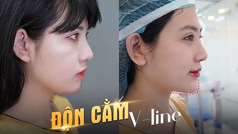 Dáng cằm xinh cho gương mặt thêm lung linh.!