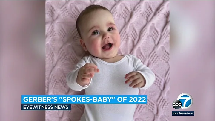 2022 Gerber baby contest winner shines spotlight o...