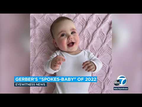 2022 Gerber baby contest winner shines spotlight on limb differences l ABC7