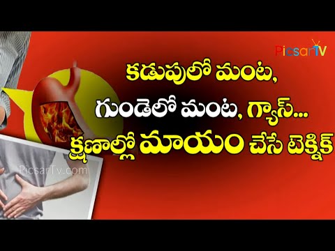 కడుపులో మంట # గుండెలో మంట | గ్యాస్ ...నిమిషాల్లో మాయం చేసే టెక్నిక్ # Stomach Pain # Heart Pain