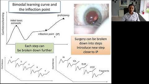 Lecture: Cataract Phacoemulsification Surgery: Optimizing Trainer Supervision and Trainee Learning
