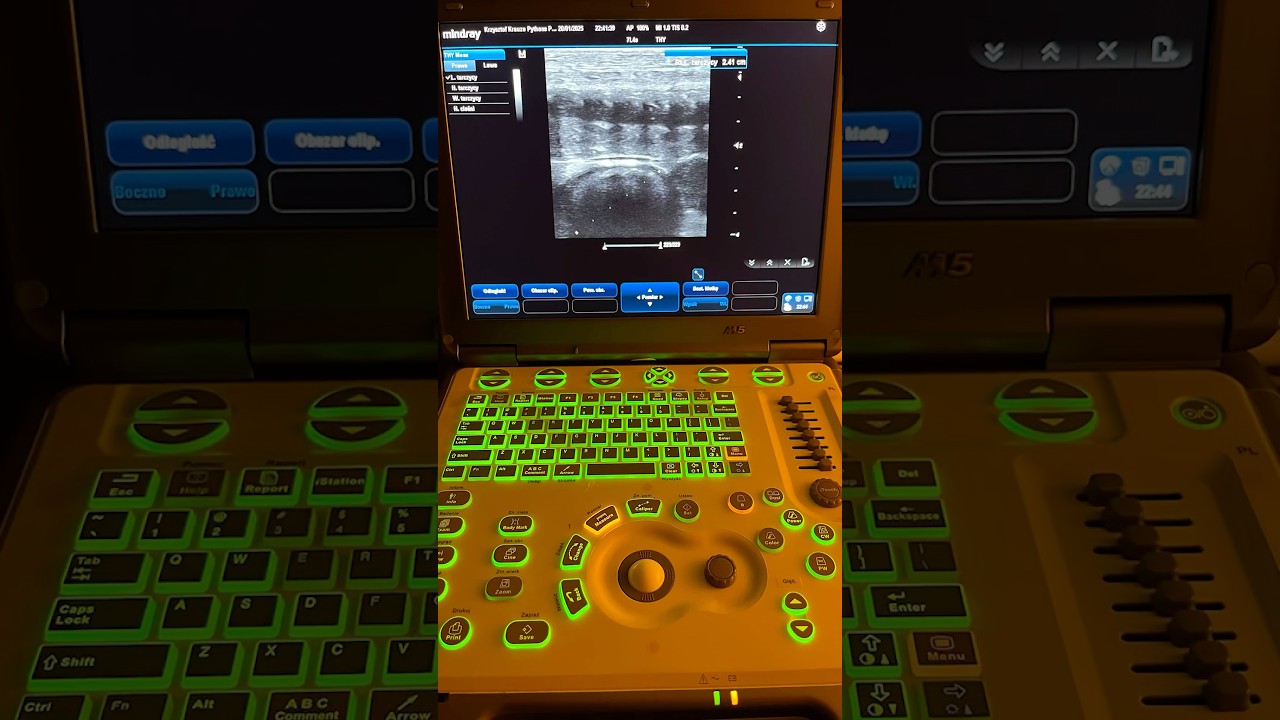 USG samic pytona królewskiego🤩 #ultrasound #pythonregius #pyton #mindray #snakes