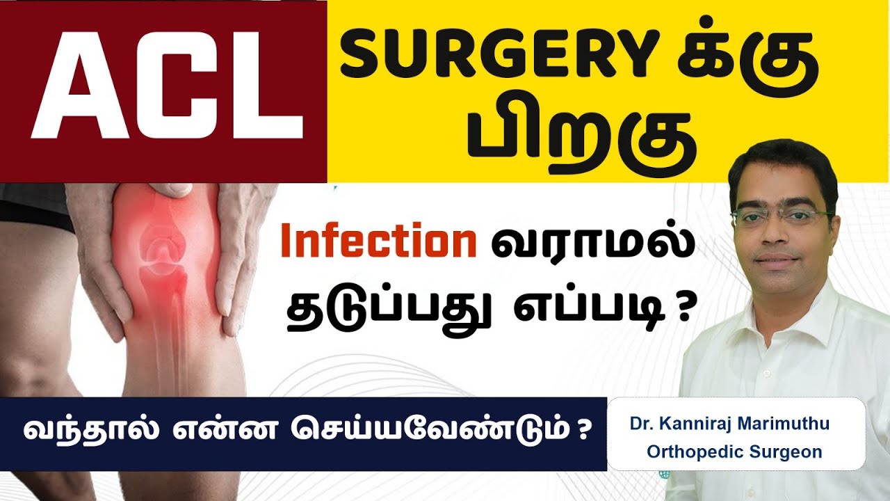 ACL Surgeryக்கு பிறகு infection வராமல் தடுப்பது எப்படி ? How to prevent ...