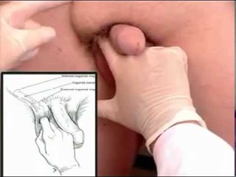 Penis Scientific Exam  (Public Domain Video - Adults Only)