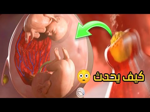 فيديو: كيف ينمو التوائم في الرحم؟