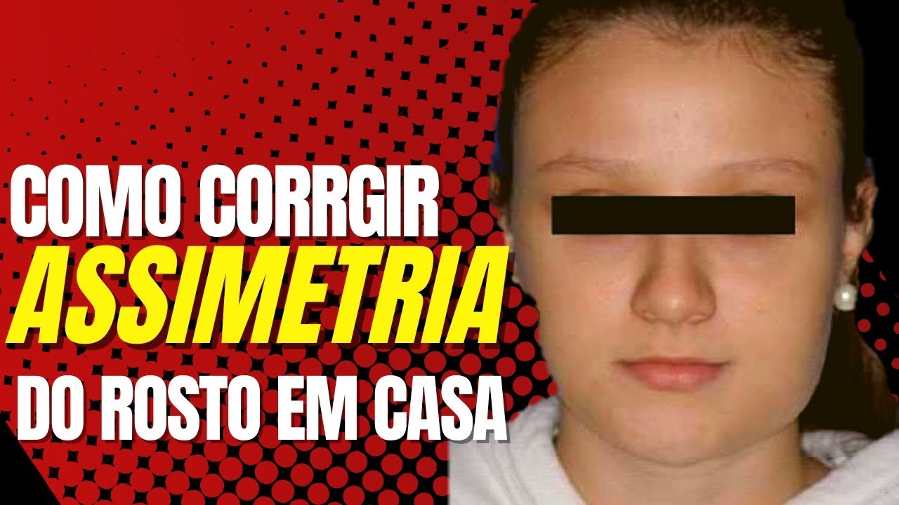 Assimetria do rosto - Rosto Inchado. 