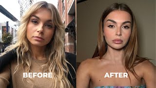 EVERYTHING I'VE HAD DONE TO MY FACE (lip tattoo, plastic surgery & more) by Allegra Shaw 50,868 views 5 months ago 15 minutes