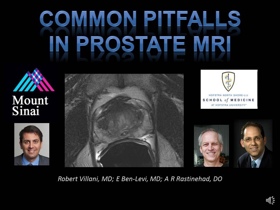 pitfalls prostate mri radiographics