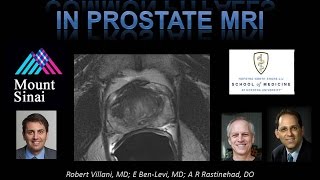 8. Prostate MRI: Common Imaging Pitfalls