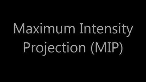 Maximum Intensity Projection (MIP)
