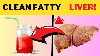 Say Goodbye to Fatty Liver with This Secret Drink! #WellnessTips #CleanseProgram