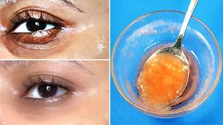 Antes De Dormir, Hacer Esto Para Eliminar Las Ojeras Y Arrugas Debajo De Los Ojos