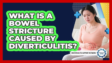 What Is A Bowel Stricture Caused By Diverticulitis? - Diverticulitis Support Network