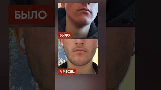 Не было НИ ОДНОГО ВОЛОСКА! Результат за 4 месяца